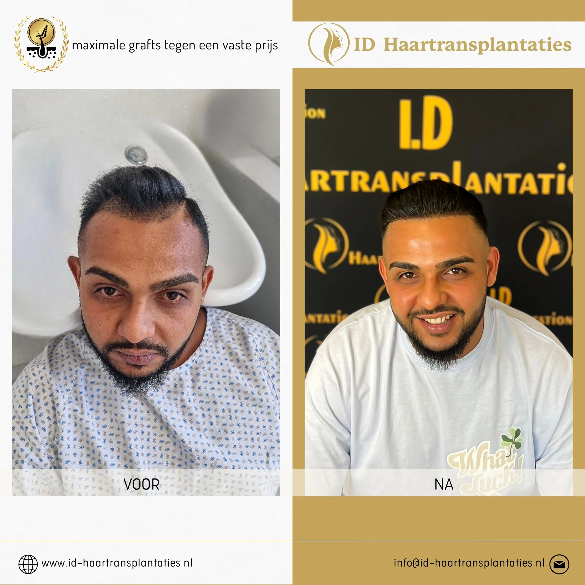 ID HAARTRANSPLANTATIONEN