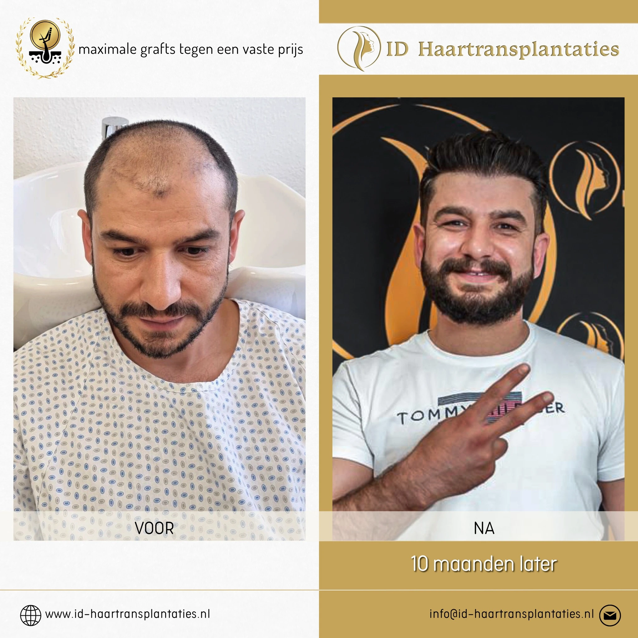 ID HAARTRANSPLANTATIONEN